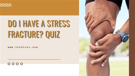 Do i have a stress fracture quiz - Just as with sprains, your doctor will take x-rays of your foot to confirm the diagnosis and determine the extent of the injury. If the break is a stress or hairline fracture, you may need a CT scan to detect the break. The best form of treatment will depend on the severity of the fracture, and may include: Pain medications